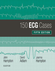 کتاب 150 کیس الکتروکاردیوگرام – EKG