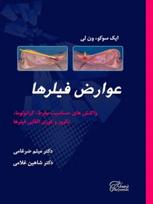 دانلود ایبوک عوارض فیلرها (Filler Complications)