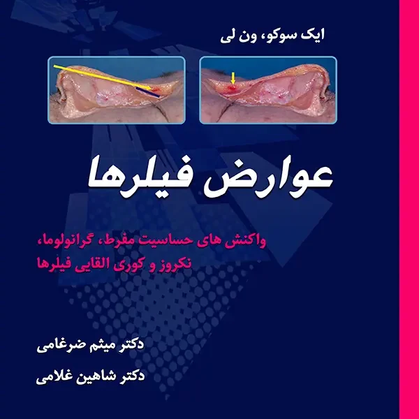 دانلود ایبوک عوارض فیلرها (Filler Complications)